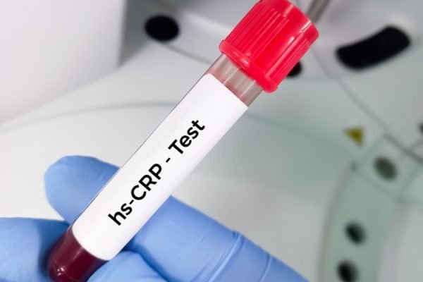 advanced-immunoassay-system6